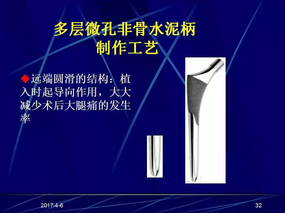 髋关节置换手术技巧及并发症的防范