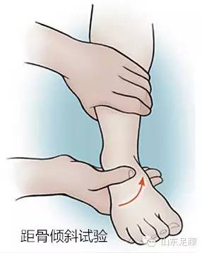 急性踝关节扭伤与慢性踝关节不稳