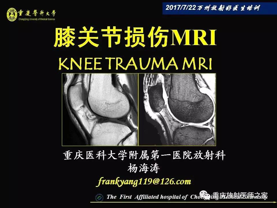 膝关节损伤的MRI诊断技巧