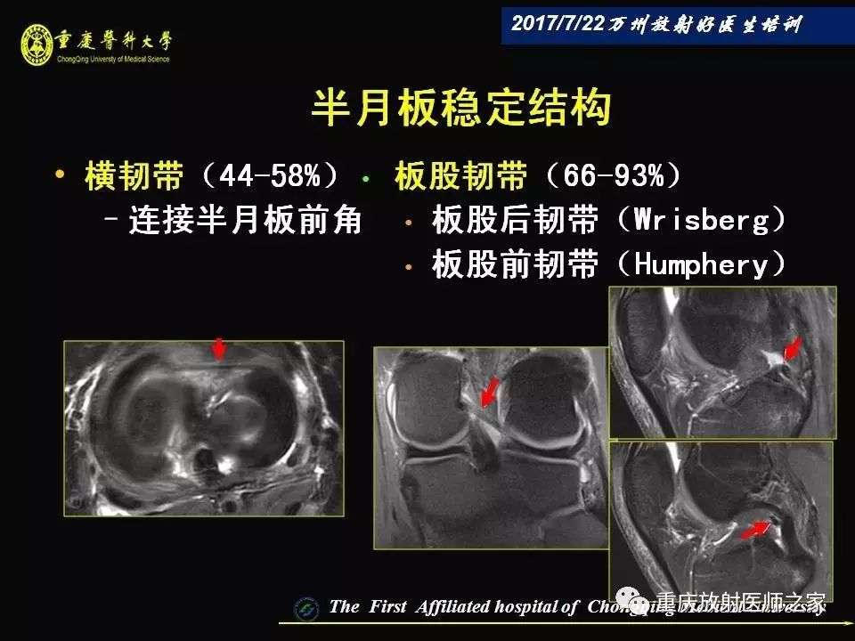 膝关节损伤的MRI诊断技巧