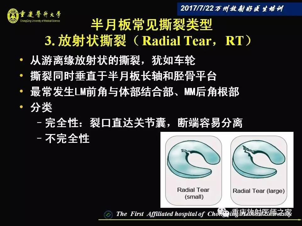 膝关节损伤的MRI诊断技巧