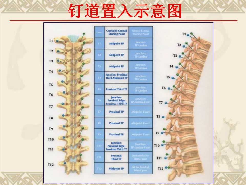 脊柱侧弯的治疗方法及对策
