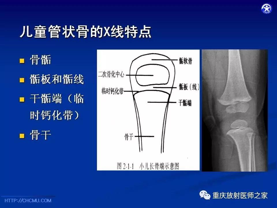 儿童骨创伤的影像学诊断