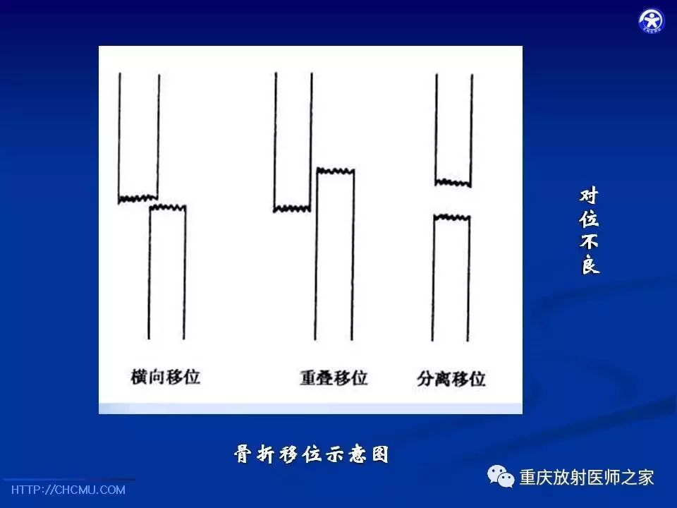 儿童骨创伤的影像学诊断