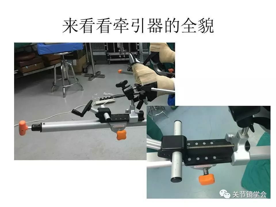 揭秘髋关节镜的手术过程