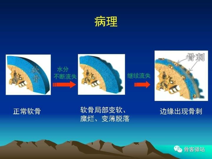 膝关节骨性关节炎的认识和手术治疗