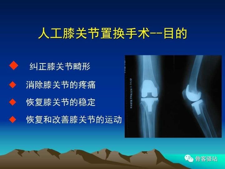 膝关节骨性关节炎的认识和手术治疗