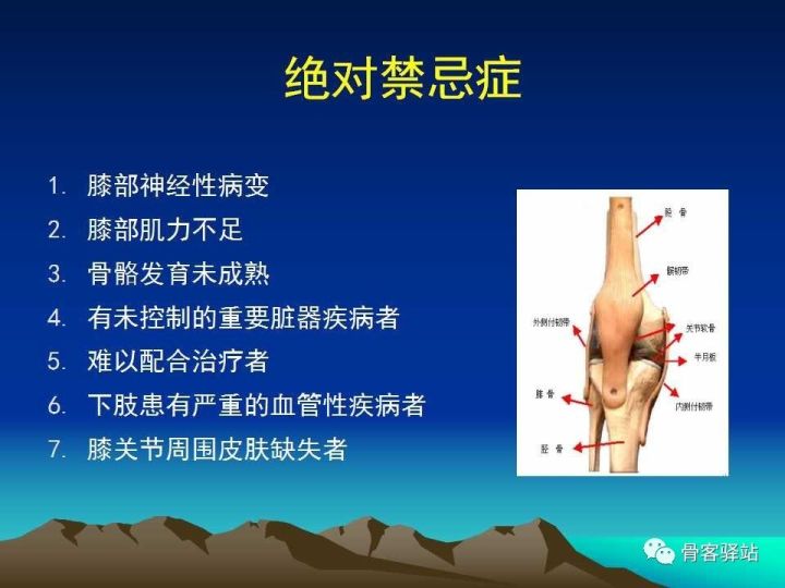 膝关节骨性关节炎的认识和手术治疗