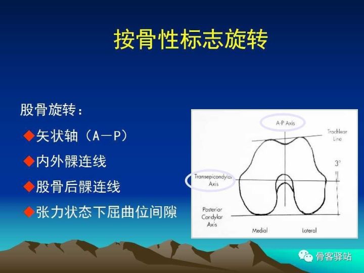 膝关节骨性关节炎的认识和手术治疗