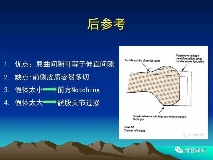 膝关节骨性关节炎的认识和手术治疗