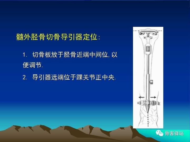 膝关节骨性关节炎的认识和手术治疗