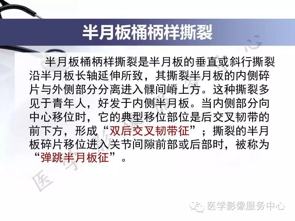 半月板病变的磁共振诊断，值得一看！