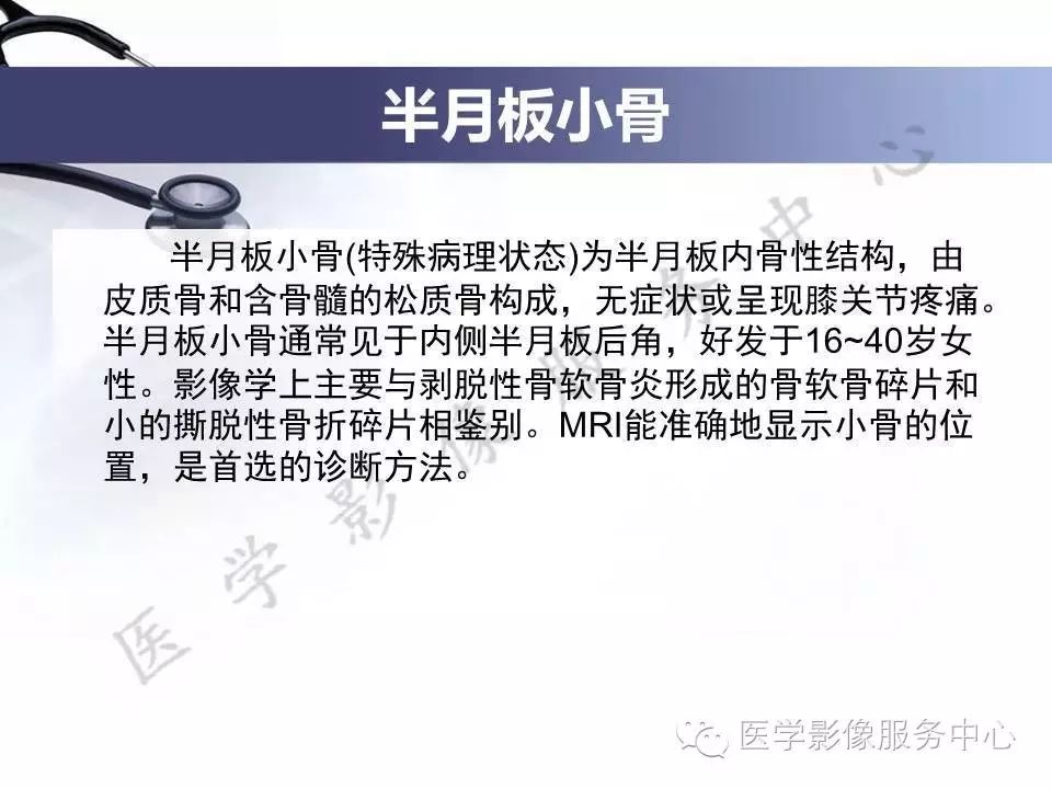 半月板病变的磁共振诊断，值得一看！