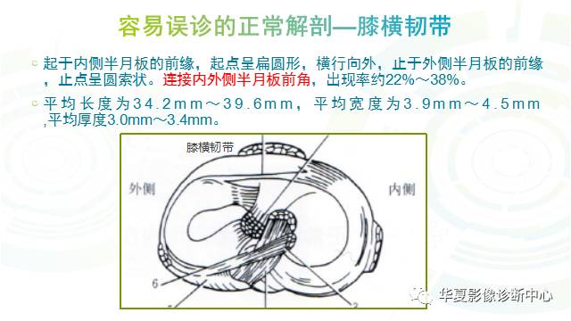 那些易误诊为半月板损伤的细节您都认识吗？