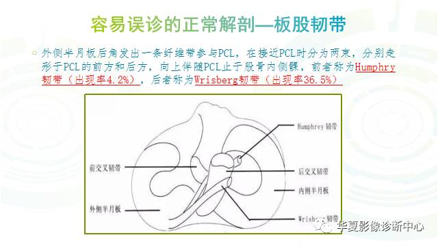 那些易误诊为半月板损伤的细节您都认识吗？