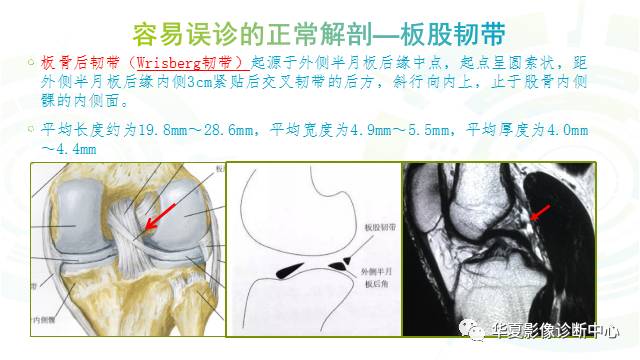 那些易误诊为半月板损伤的细节您都认识吗？