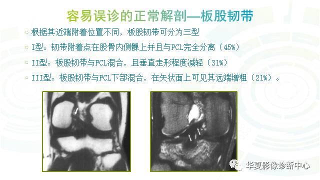 那些易误诊为半月板损伤的细节您都认识吗？