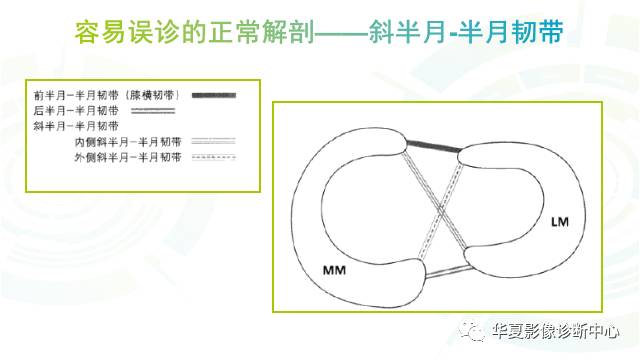 那些易误诊为半月板损伤的细节您都认识吗？