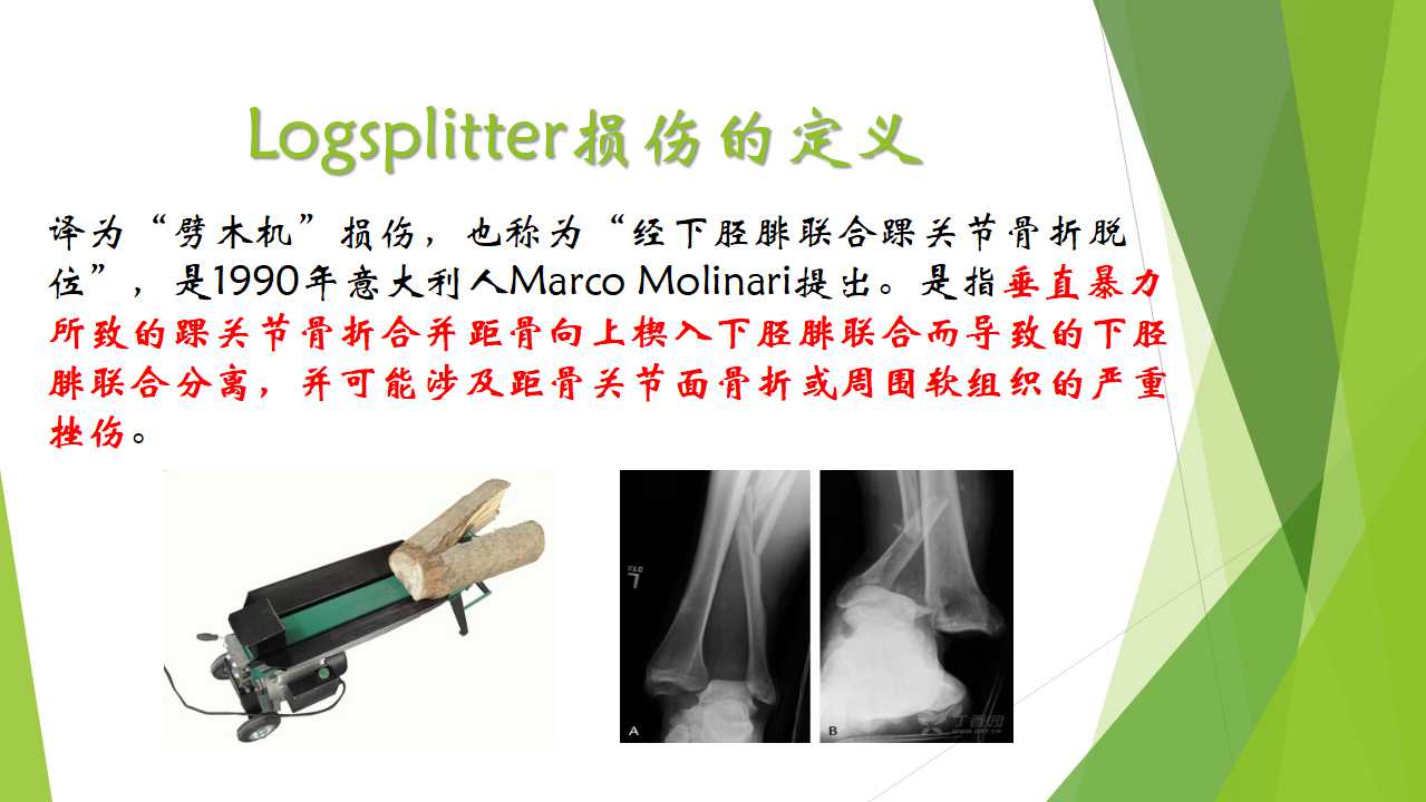 特殊类型的踝关节骨折（三）：LogsplitterFracture