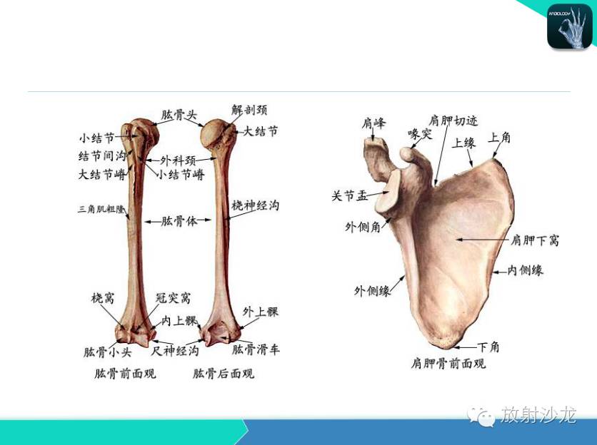 肩关节常见疾病的MRI表现