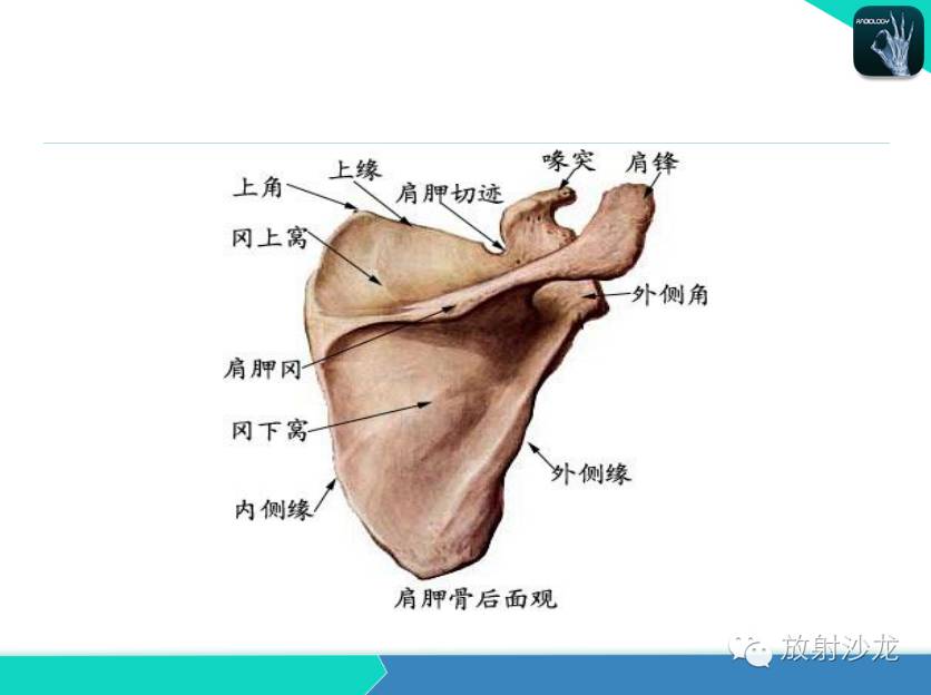 肩关节常见疾病的MRI表现