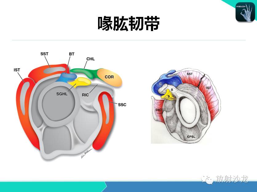 肩关节常见疾病的MRI表现