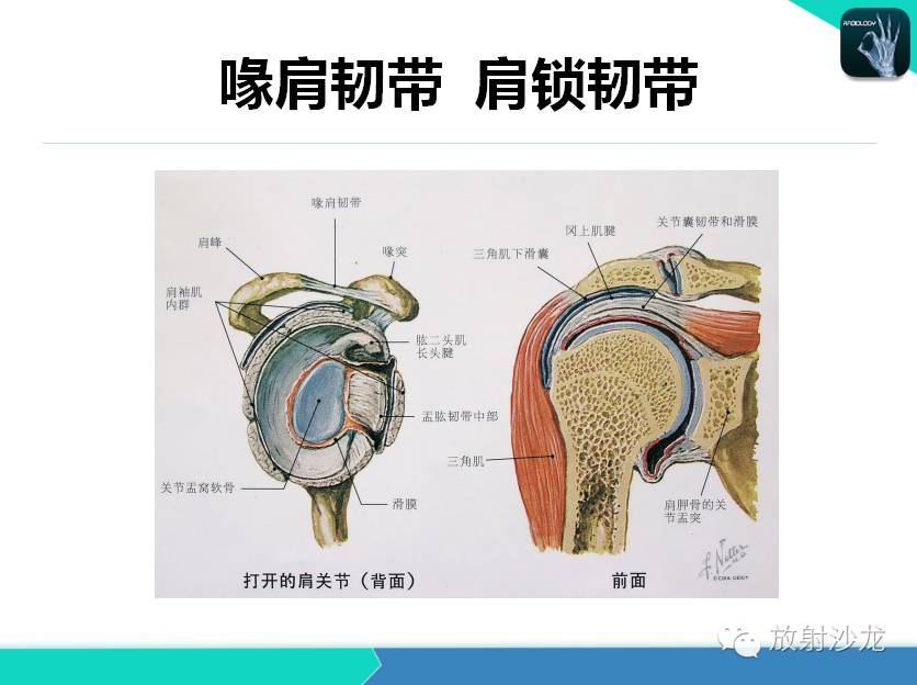 肩关节常见疾病的MRI表现