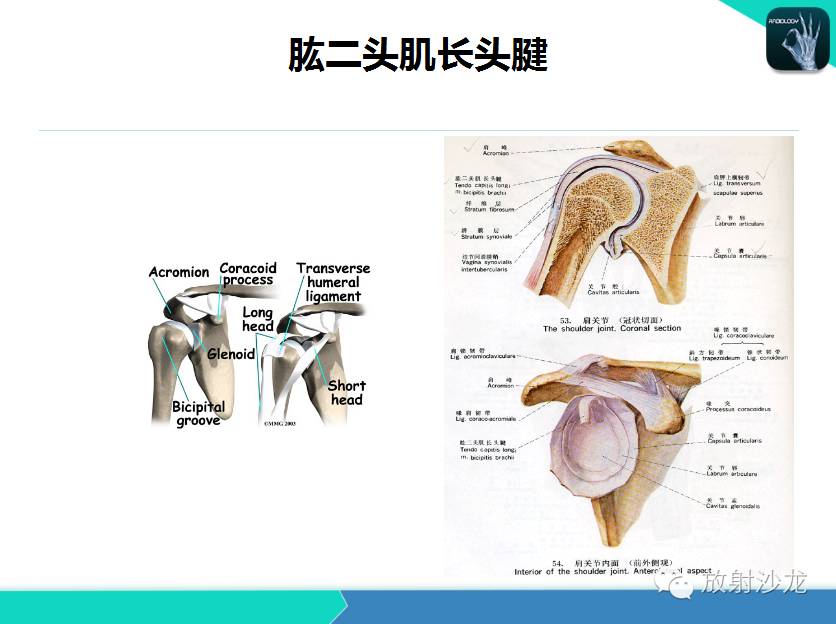 肩关节常见疾病的MRI表现