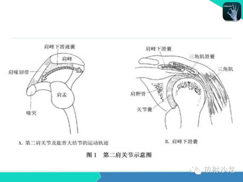 肩关节常见疾病的MRI表现