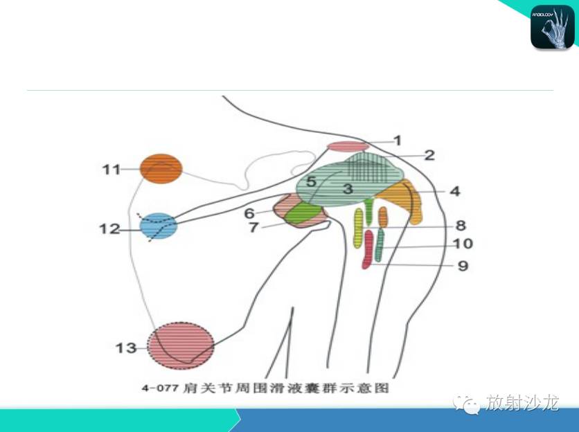 肩关节常见疾病的MRI表现