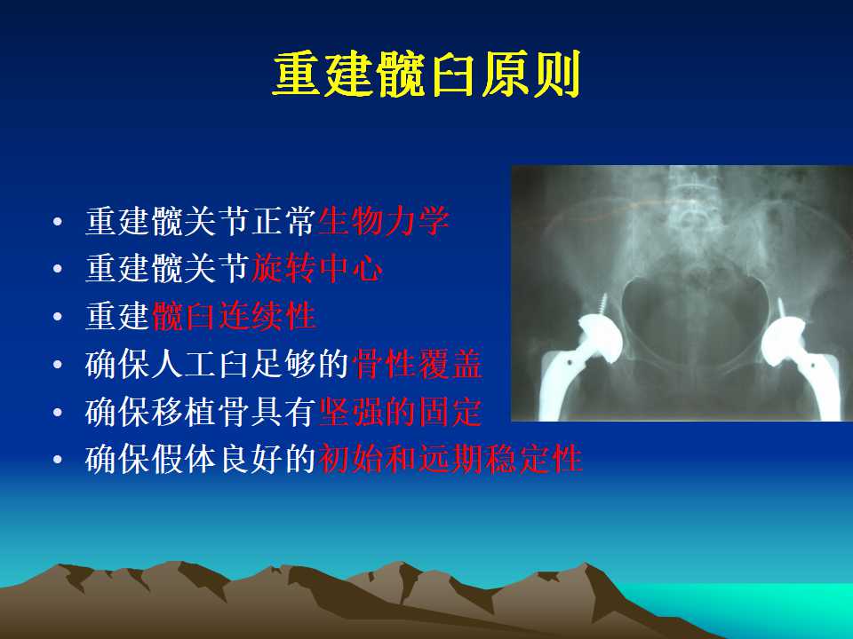 全髋关节翻修的原因及处理策略