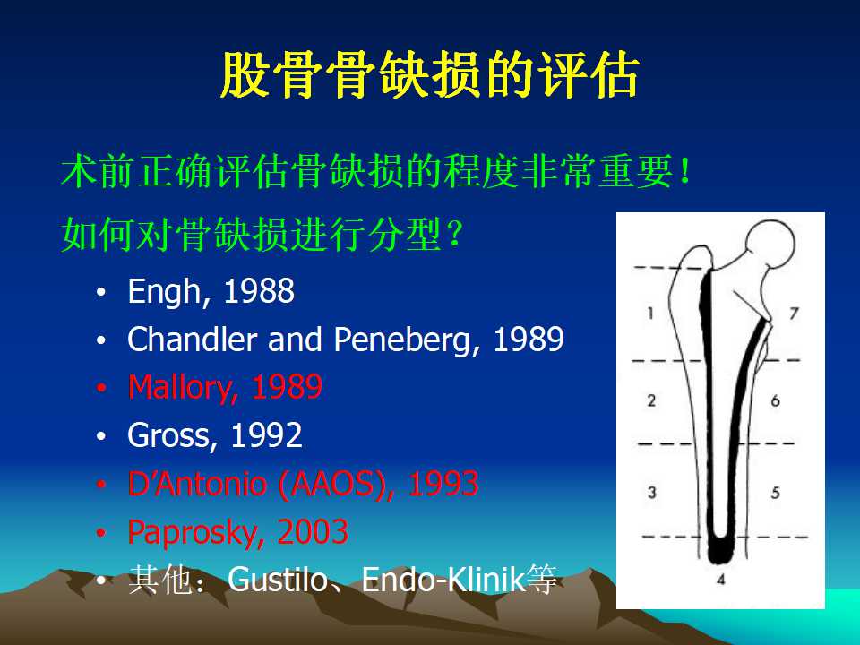 全髋关节翻修的原因及处理策略