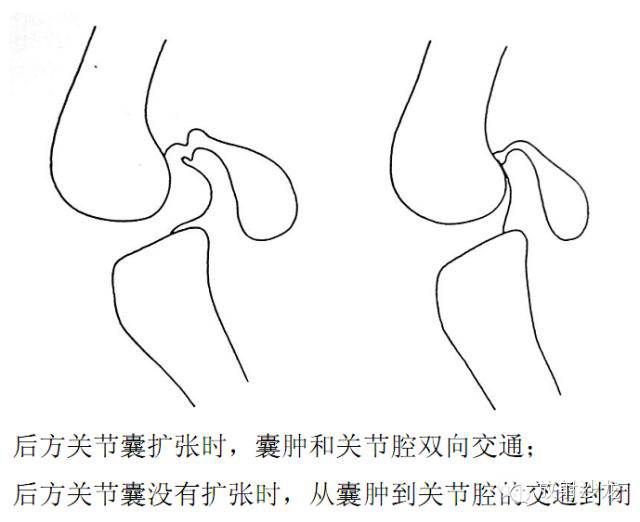 膝关节疼痛的鉴别诊断要点