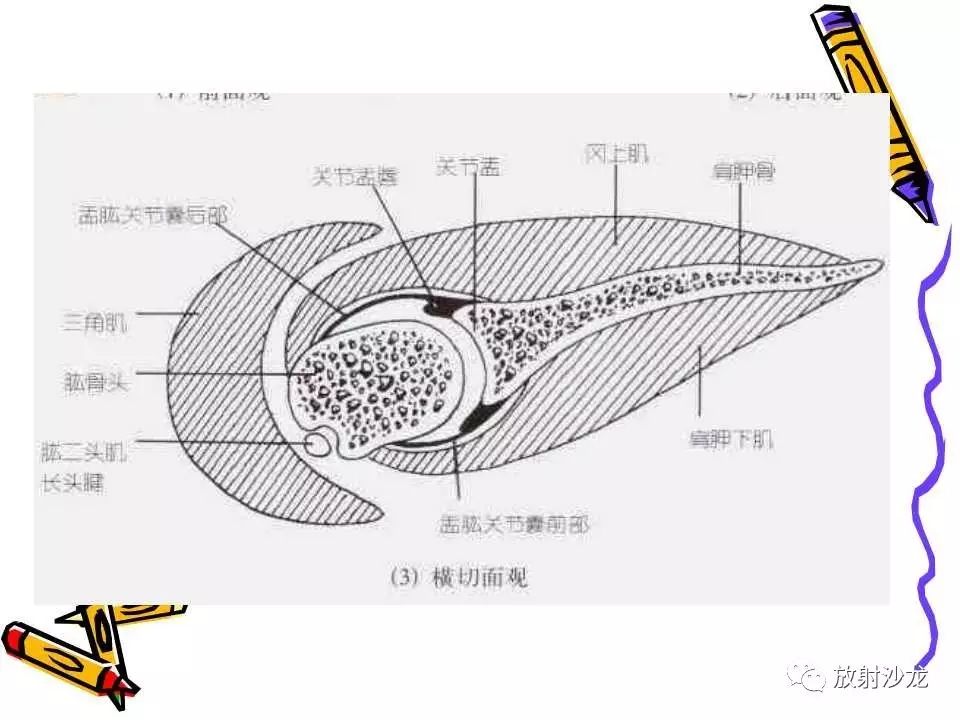 肩关节常见创伤性病变你了解多少？