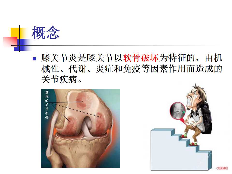 膝骨性关节炎的临床诊治策略