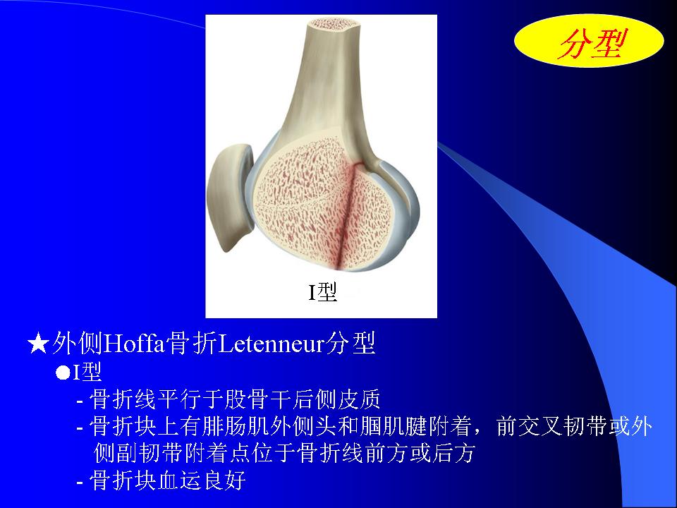 股骨Hoffa骨折的诊断与治疗技巧