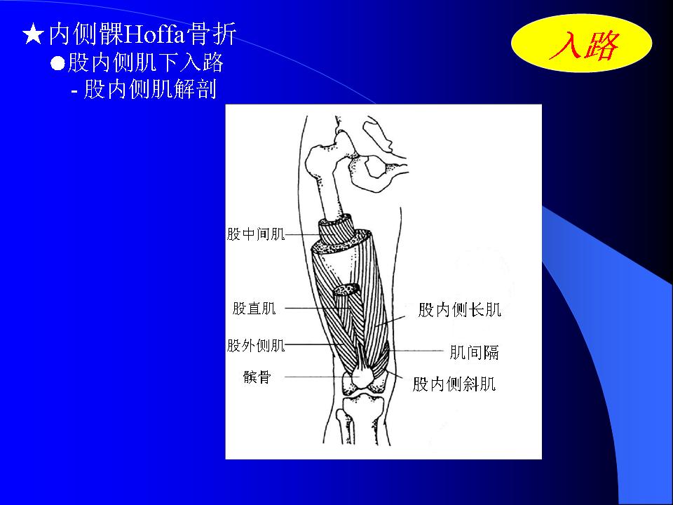 股骨Hoffa骨折的诊断与治疗技巧