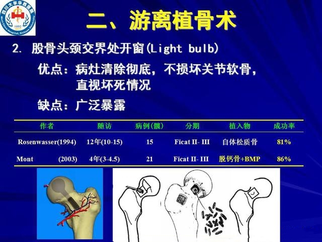 推荐