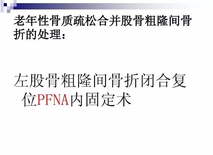 老年骨质疏松性骨折的治疗原则