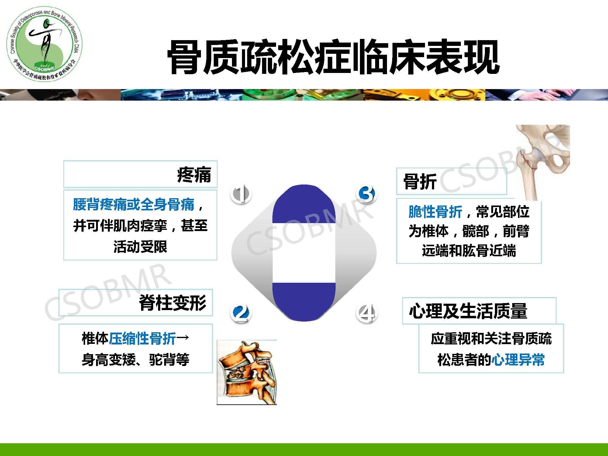 【指南】骨质疏松症临床表现、诊断及鉴别诊断