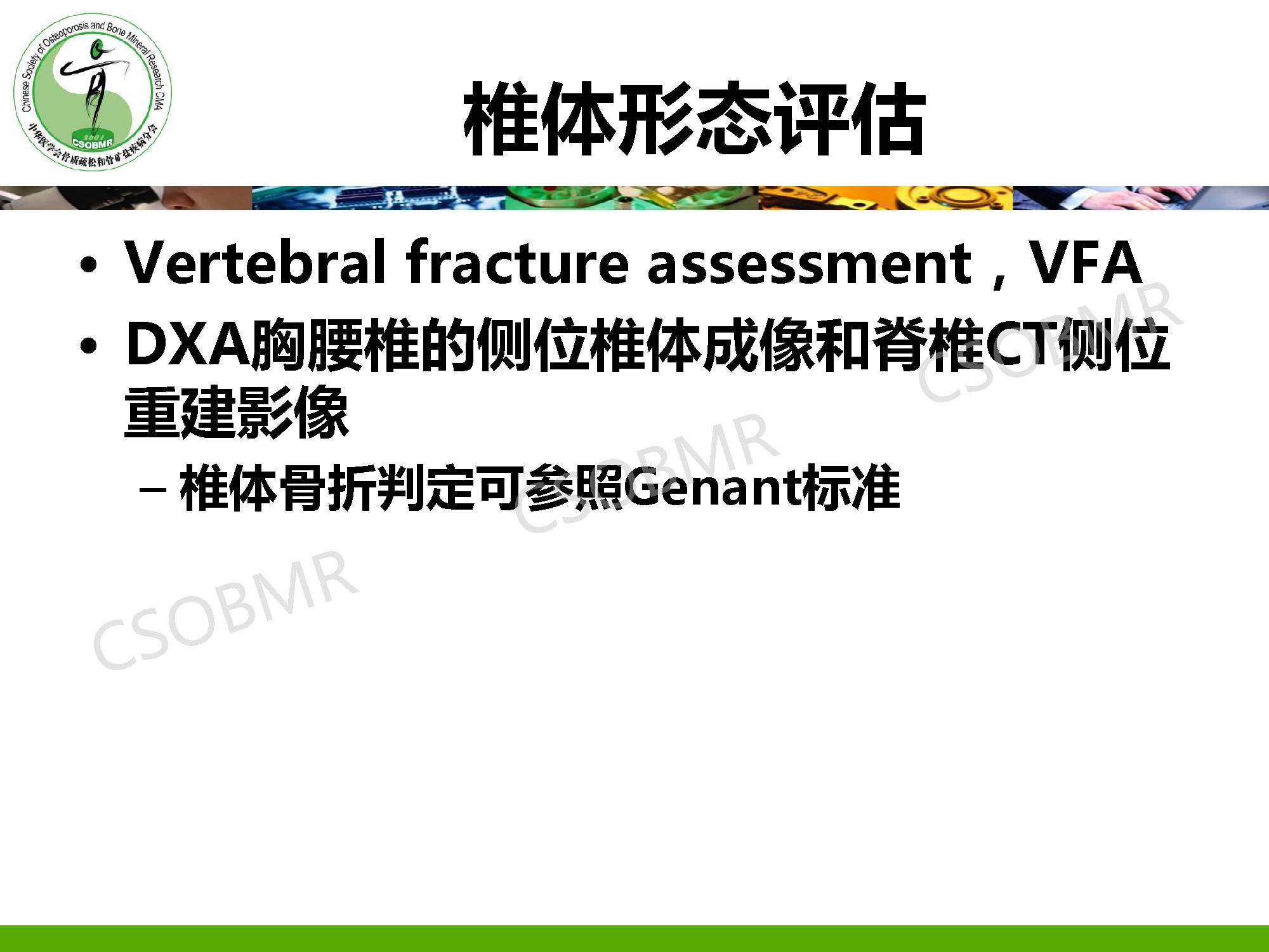 【指南】骨质疏松症临床表现、诊断及鉴别诊断