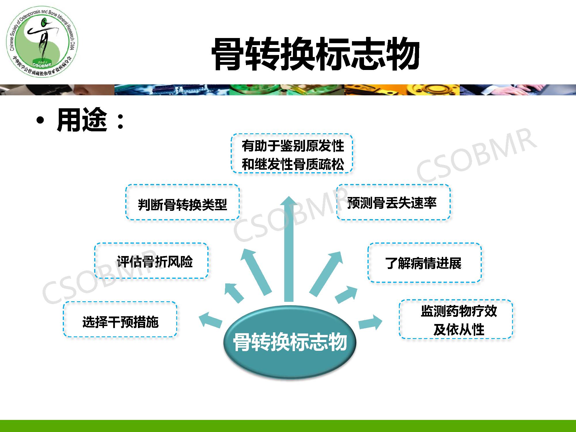 【指南】骨质疏松症临床表现、诊断及鉴别诊断