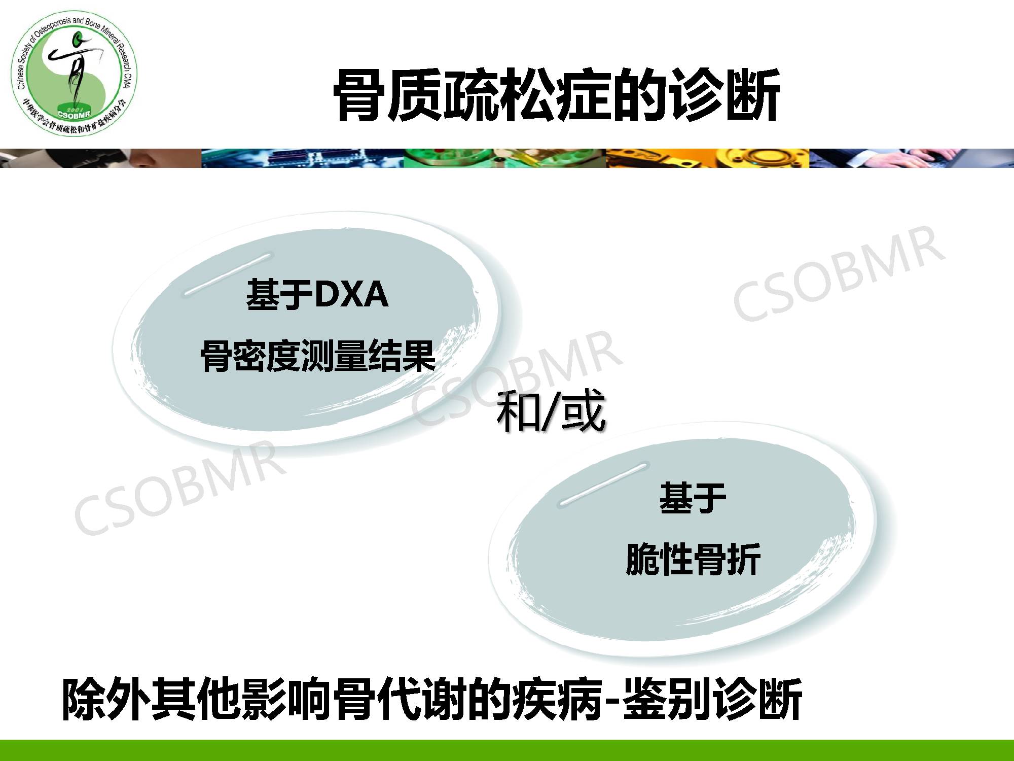 【指南】骨质疏松症临床表现、诊断及鉴别诊断