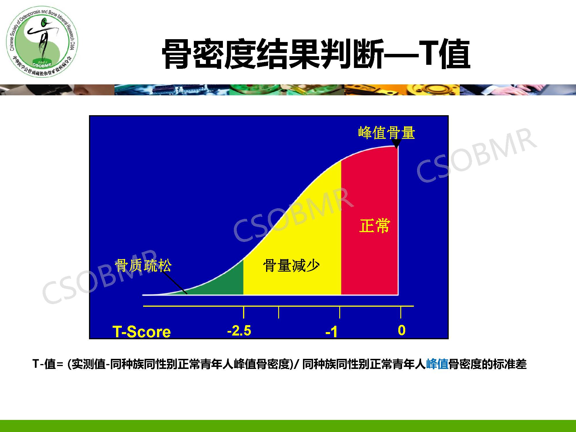 【指南】骨质疏松症临床表现、诊断及鉴别诊断