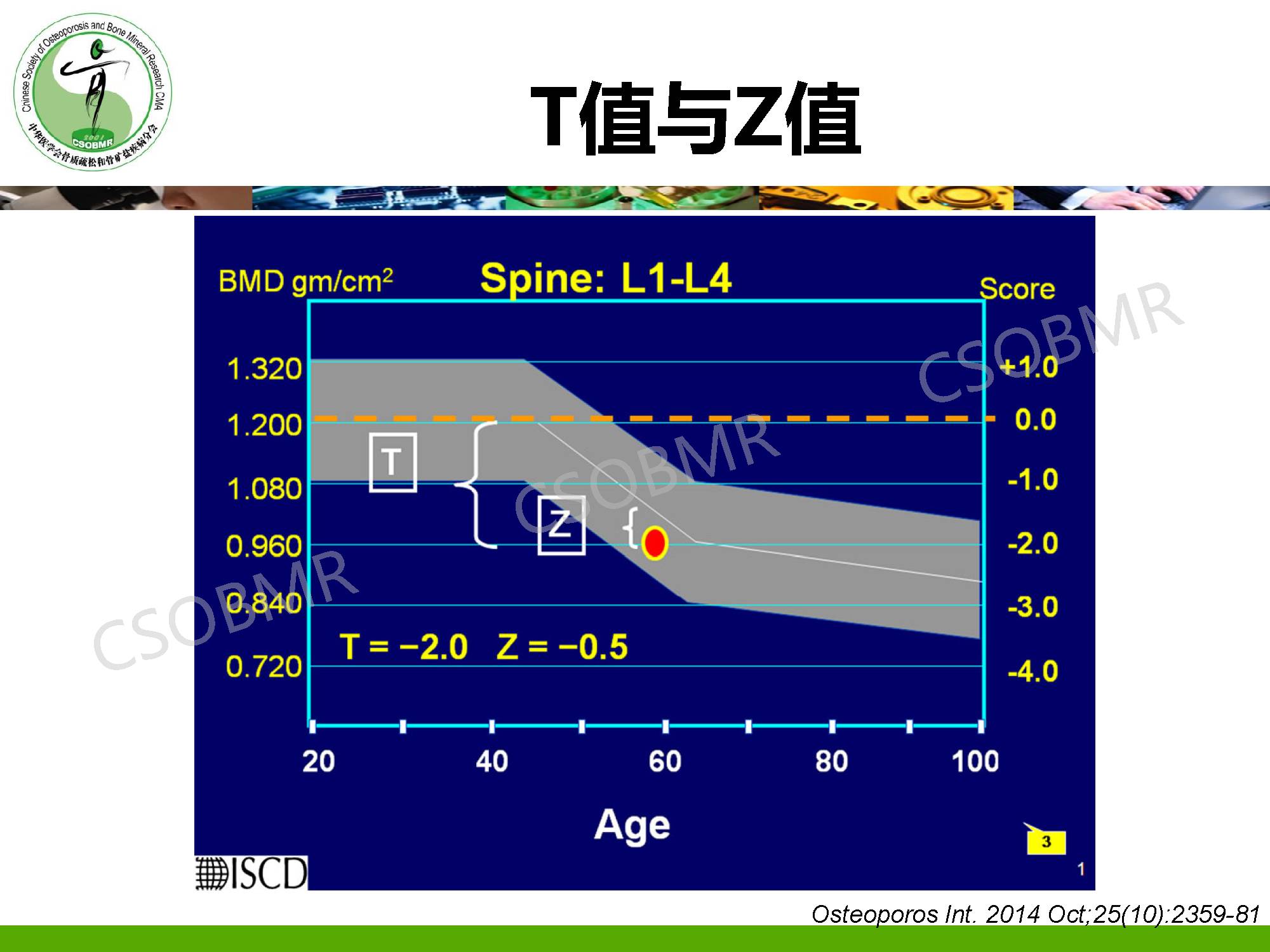 【指南】骨质疏松症临床表现、诊断及鉴别诊断