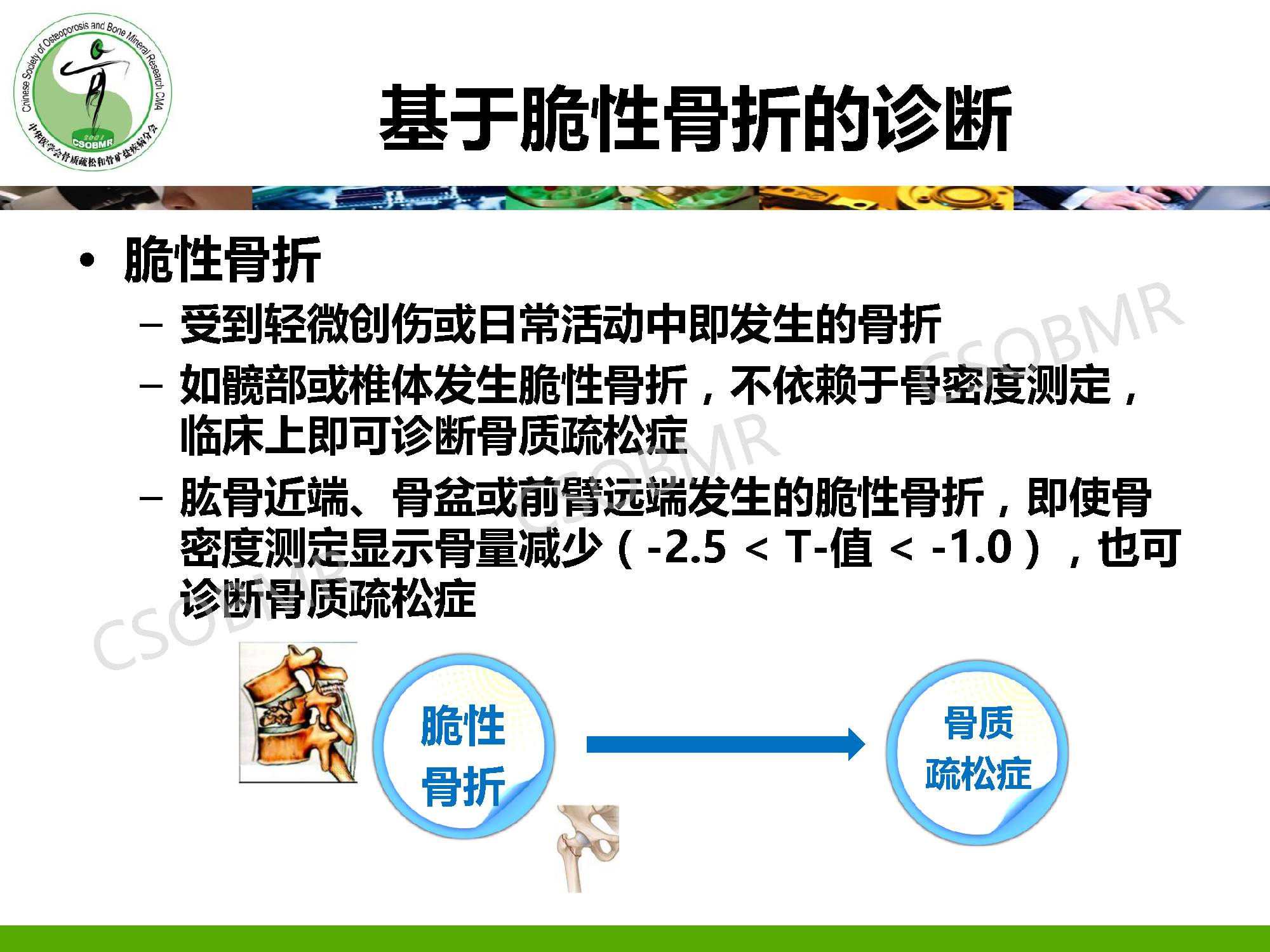 【指南】骨质疏松症临床表现、诊断及鉴别诊断