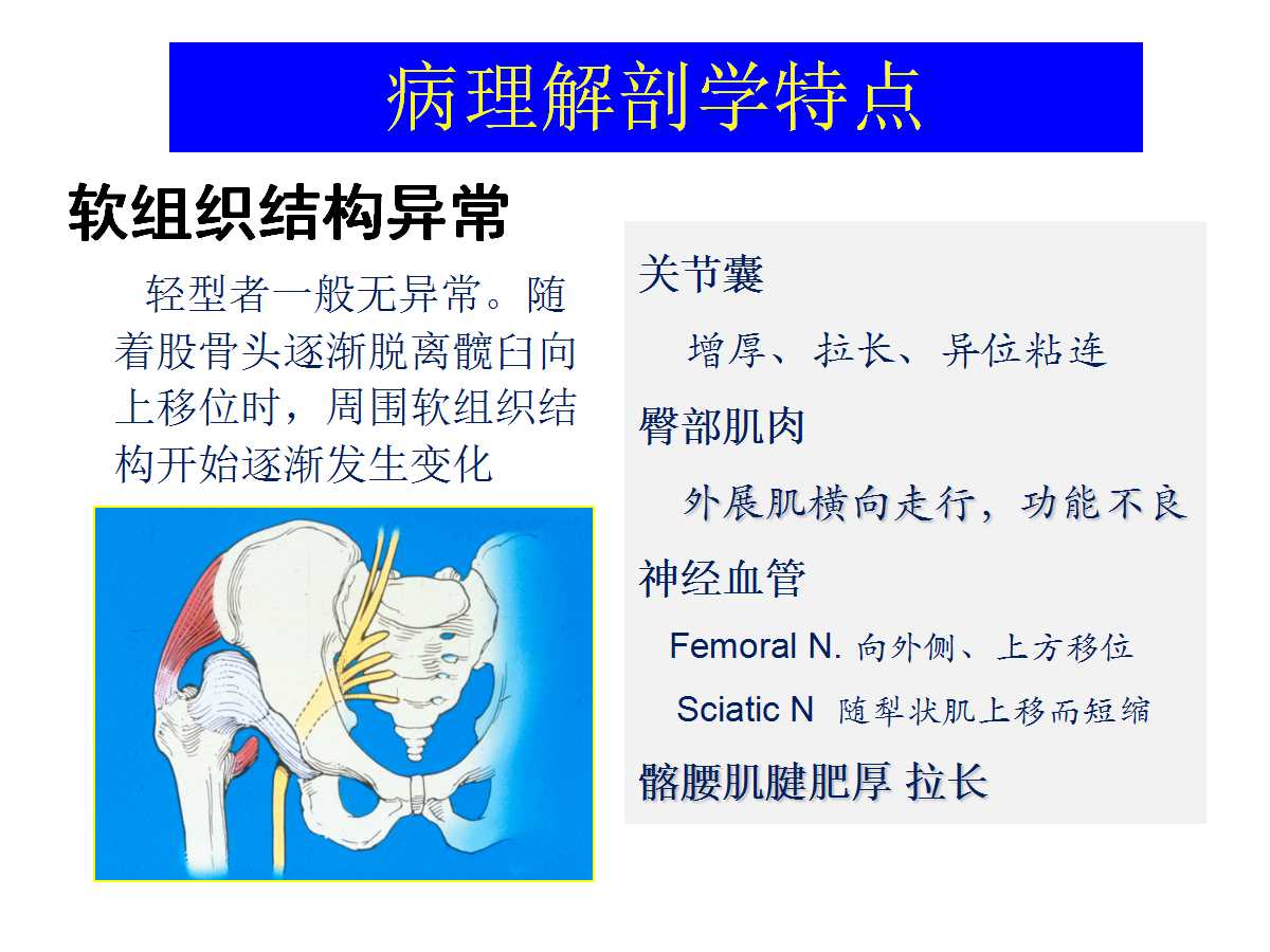 成人DDH的全髋关节置换技术