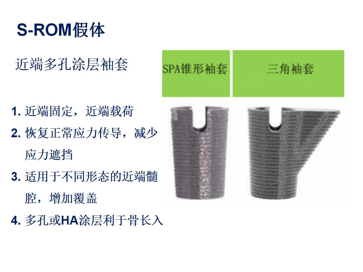 成人DDH的全髋关节置换技术