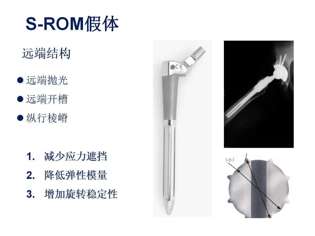 成人DDH的全髋关节置换技术