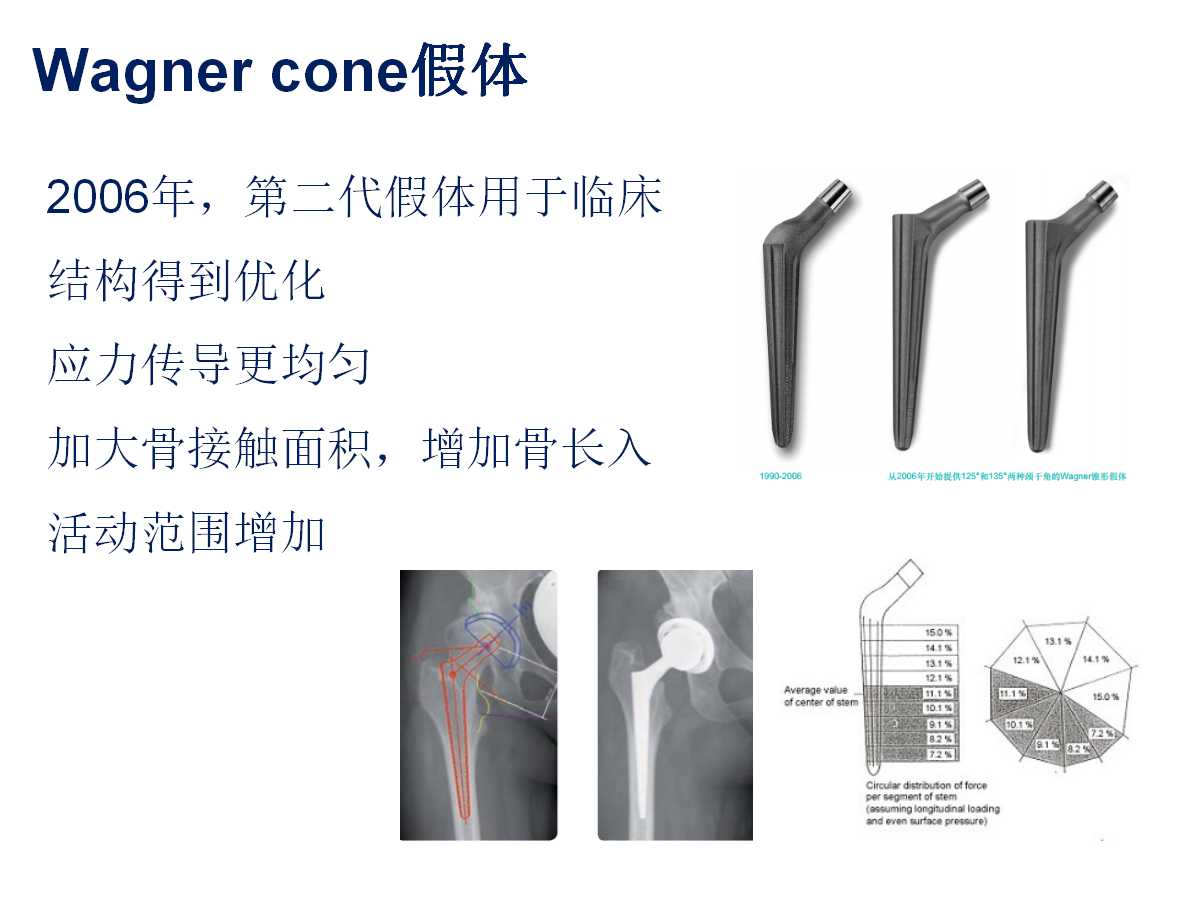 成人DDH的全髋关节置换技术